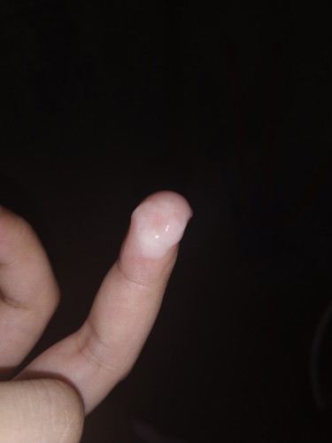 Mucus Plug