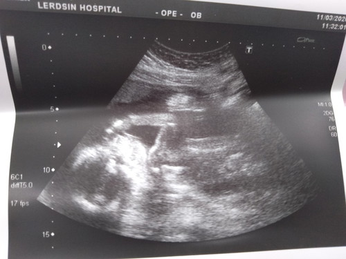ได้ลูกสาวสมใจอีแม่มันเลย?