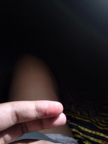 37วีคพอดี