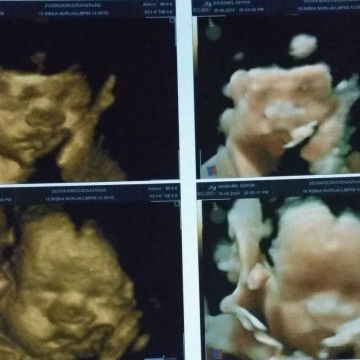 Rizka Nurlia profile icon