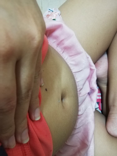 ท้อง6 week3วัน แต่รุ้สึกเหมือนท้องใหญ่