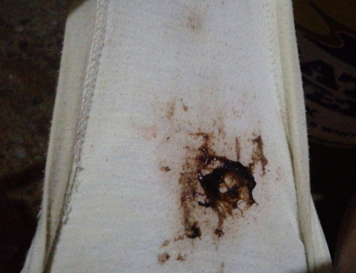 40 Weeks And 2 Days Today