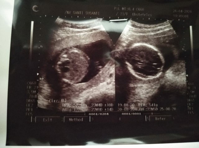 21w