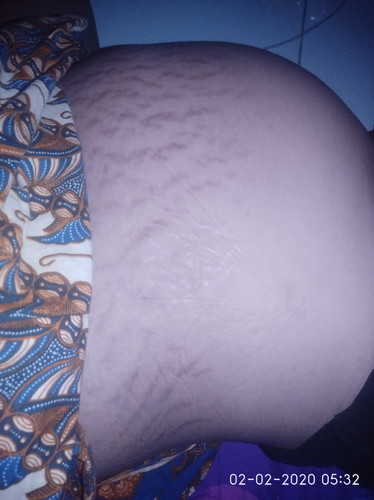 pengen ilang caranya gmna