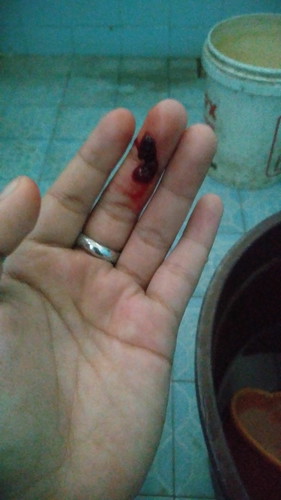 keluar darah waktu bab...