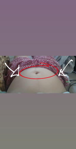 Pagsiksik ng baby