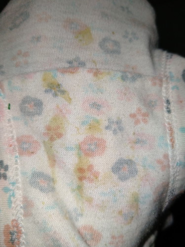 vaginal discharge of my 3 yrs old daughter