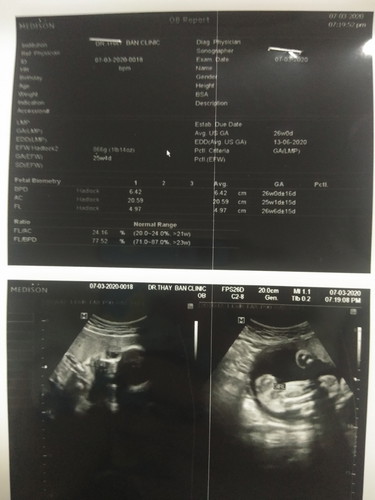 ทีม มิย. 63 ลูกน้ำหนักถึงไหนกันแล้วค่ะ ได้กี่วิคกันแล้ว บ้านนี้ 25w 866g??