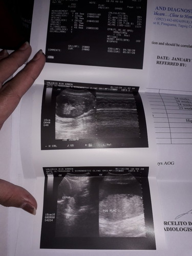 ULTRASOUND