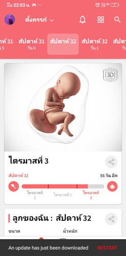 คลอดก่อน