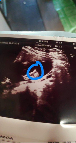 แม่ว่า เป็น ญ หรือ ช ค่ะ