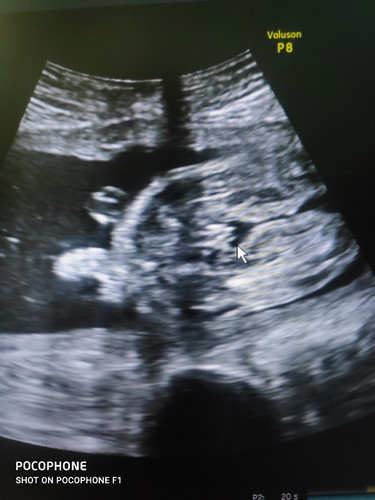 คุณแม่ ว่า ผู้หญิง หรือ ผู้ชายคะ