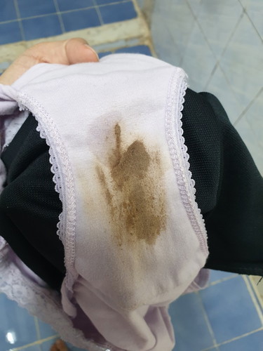ขออภัยภาพอาจจะไม่น่าดู