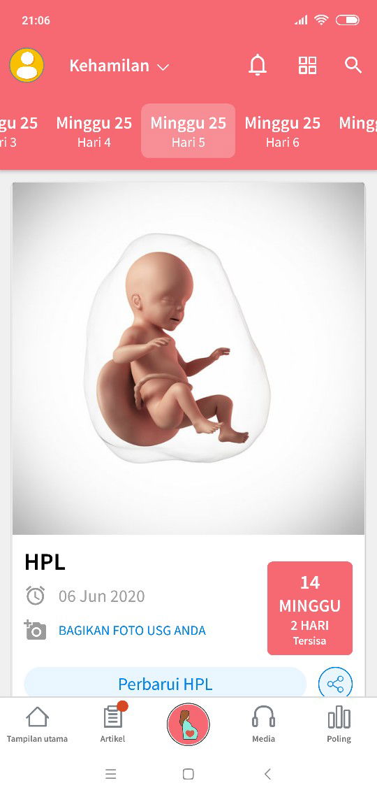 stretchmark ga di usia 25 minggu ?