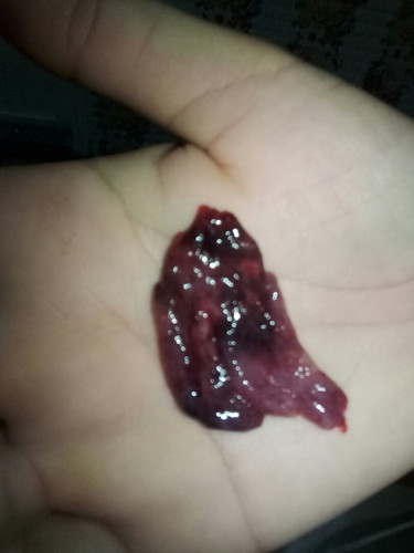 ท้องหรือไม่ท้อง น้องจะอยู่ไหม