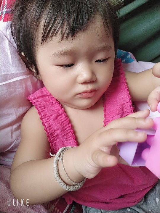 น้อง10เดือน คันหัวบ่อยเกืดจากอะไร