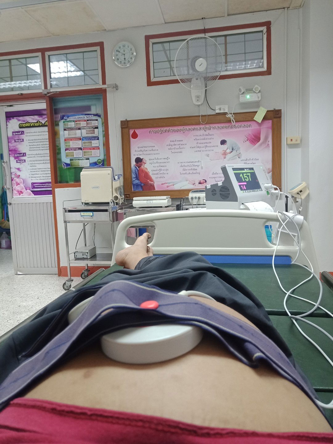 ลูกม่ดิ้น