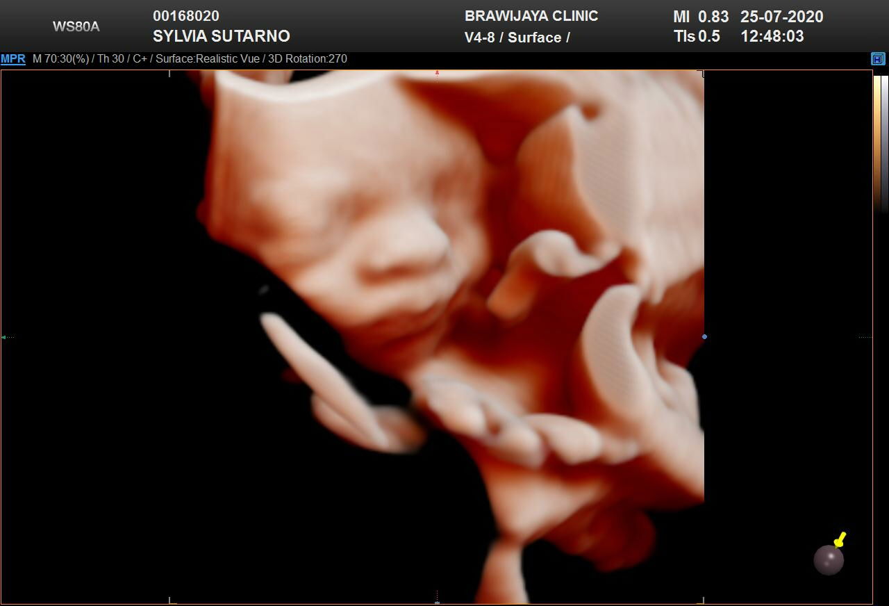 sylvia sutarno putri profile icon