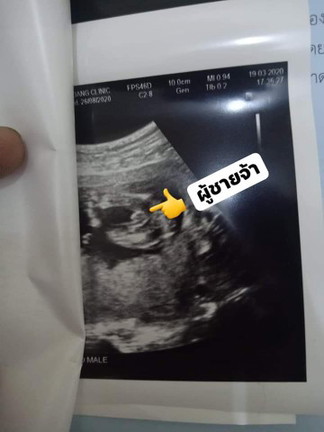 ช่วยดูหน่อยครับ ว่าเพศชายจริงๆรึเปล่า ?