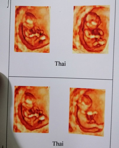 Giới Tính