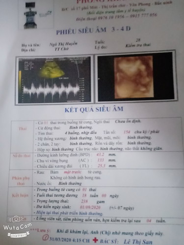 18w của bé