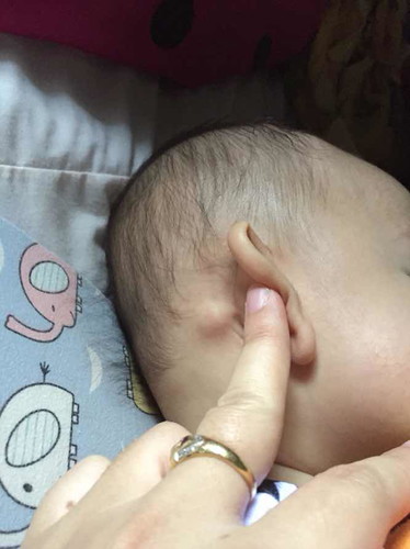 มันคืออะไร??