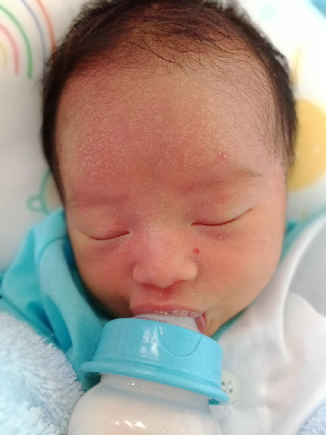 ลูกน้อยเป็นผื่นขาว