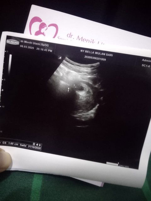 Bantu Pencerahannya Bunda-bunda