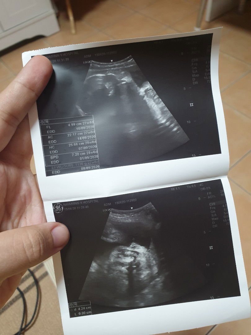 อวดลูกสาว