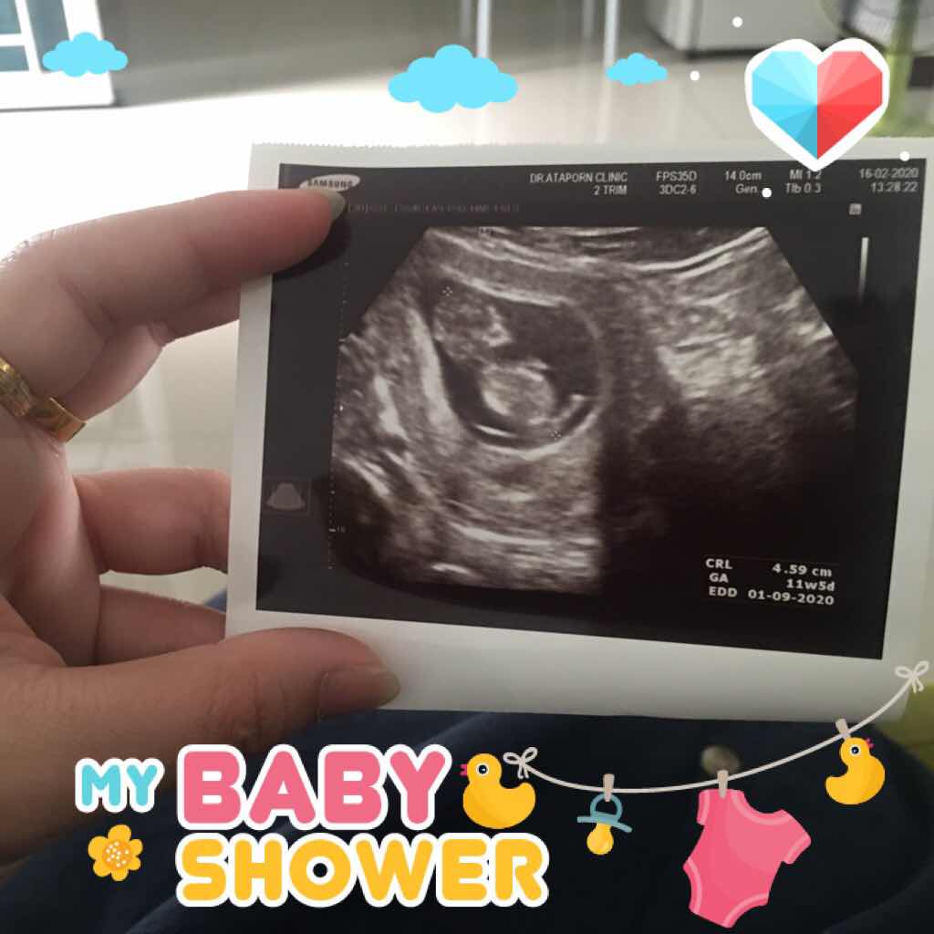 sarimon thisong profile icon