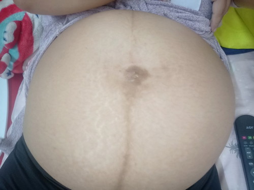 32week6dayเริ่มหน่วงท้องลงไปจิมิแล้วค่ะ
