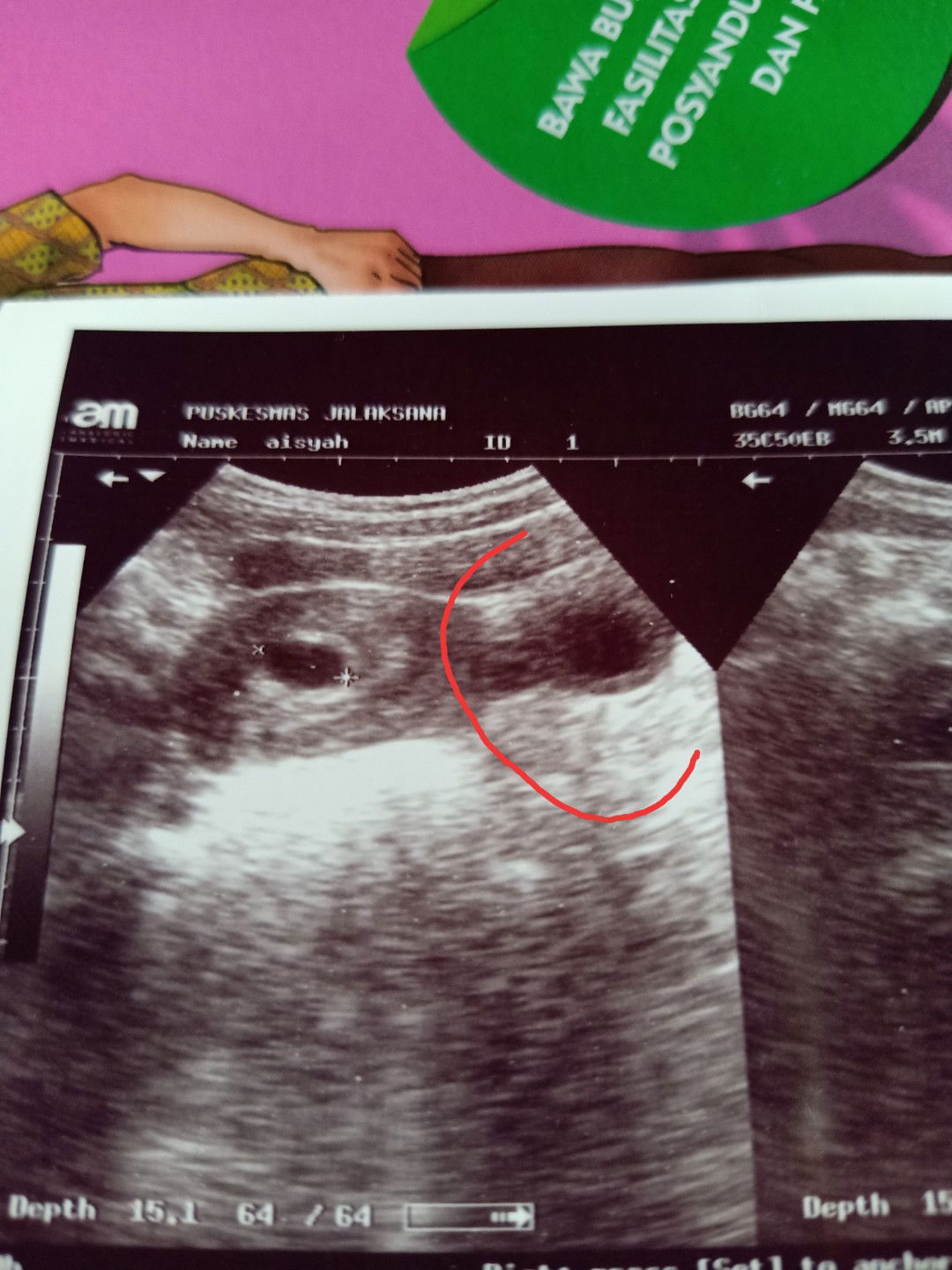 bun tolong jawab dong ?