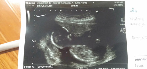 15w4dแล้วค่ะ