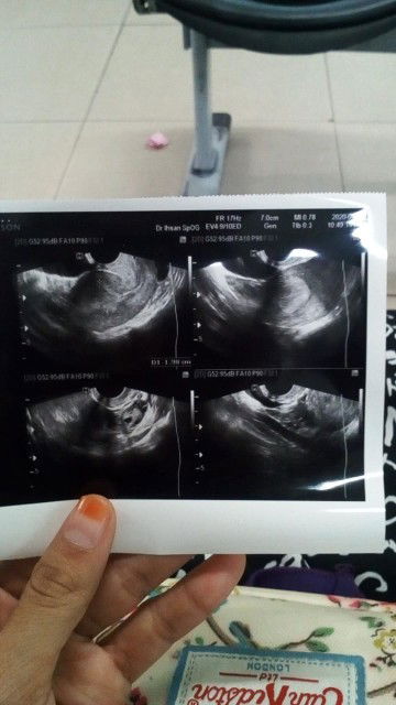 kata nya hanya dinding rahim yg menebal