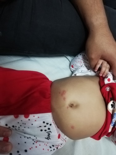Bintik2 merah yg timbul