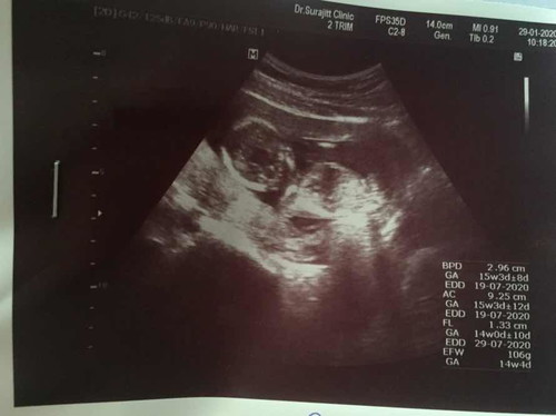 16w คือ 4 เดือนใช่มั๊ยค่ะ คือท้องแรกค่ะ ท้องยังไม่ออกเลย