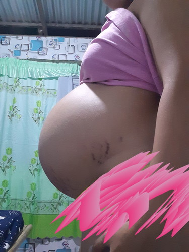 36 weeks