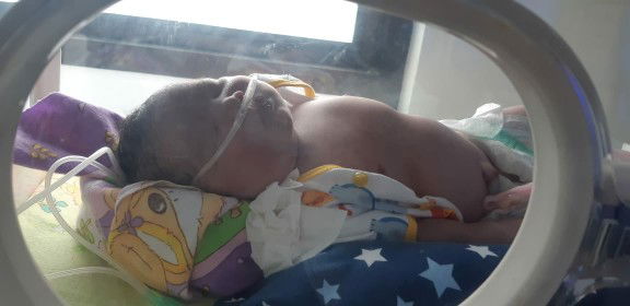 bayi gula darah rendah