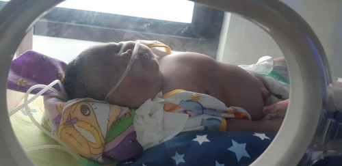 bayi gula darah rendah