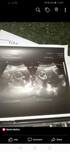 baby.?