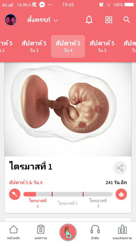 คนท้อง