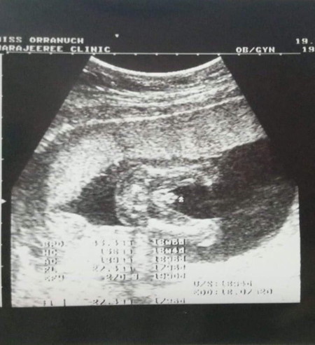 ชัดขนาดนี้ มีสิทธิ์ลุ้นหญิงได้อีกไหมคะ555