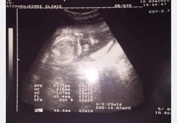 แม่ๆช่วยดูหน่อยค่ะ