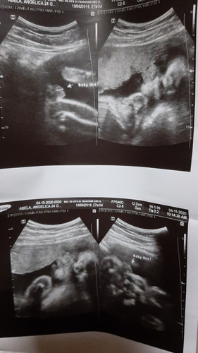 27w5D preggy