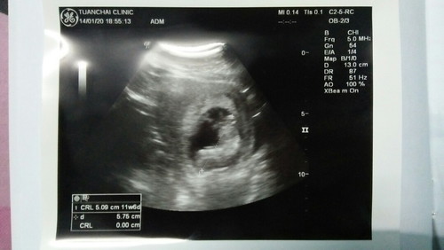 ฝากเรียบร้อย ลูก11w6d