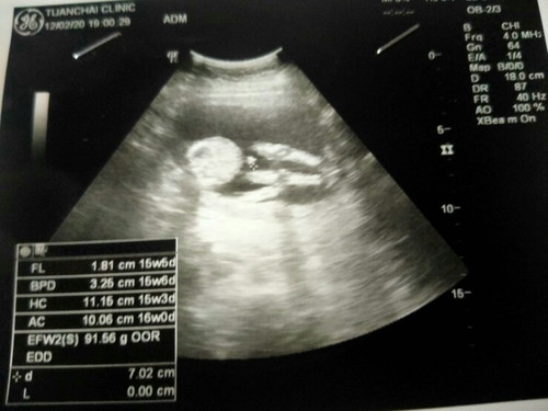 ได้ลูกชายคนแรกครับ