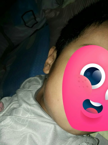 namamagang gilagid/ipin