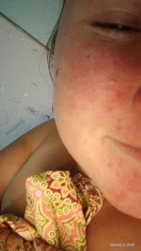 หน้าพัง