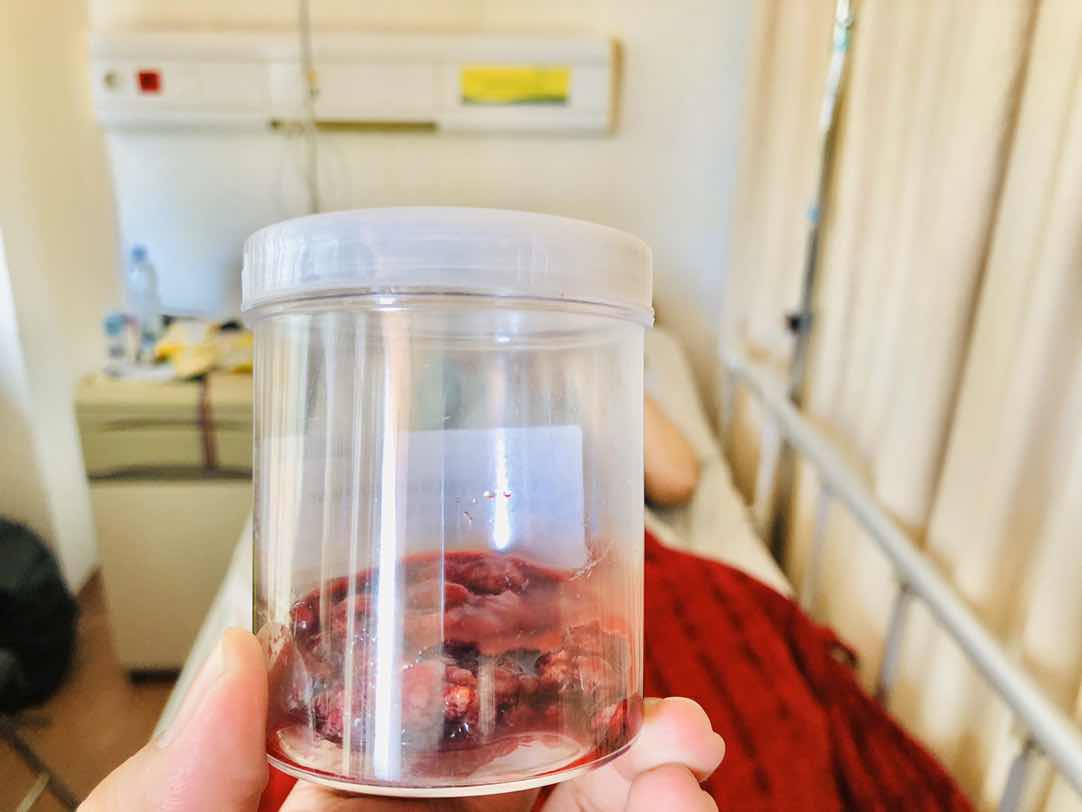 Di kuret itu sakit banget bun ternyata ?