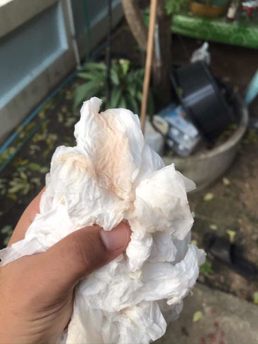 เลือดไหม